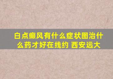 白点癫风有什么症状图治什么药才好在线约 西安远大